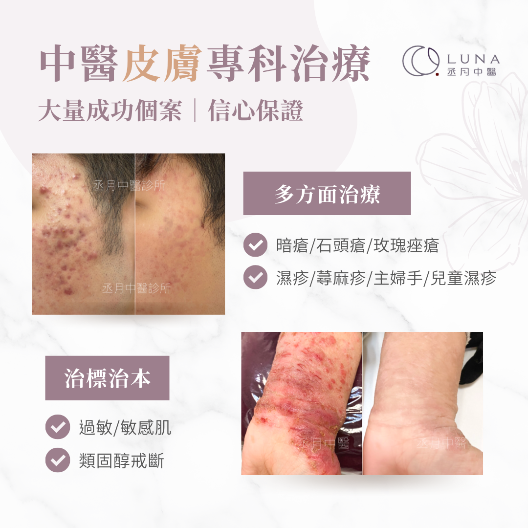 皮膚科 1 皮膚科